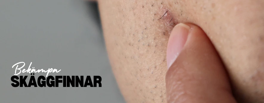 Visar upp en skäggfinne på kinden
